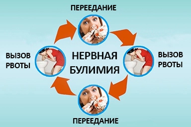 Лечение булимии в Поповке